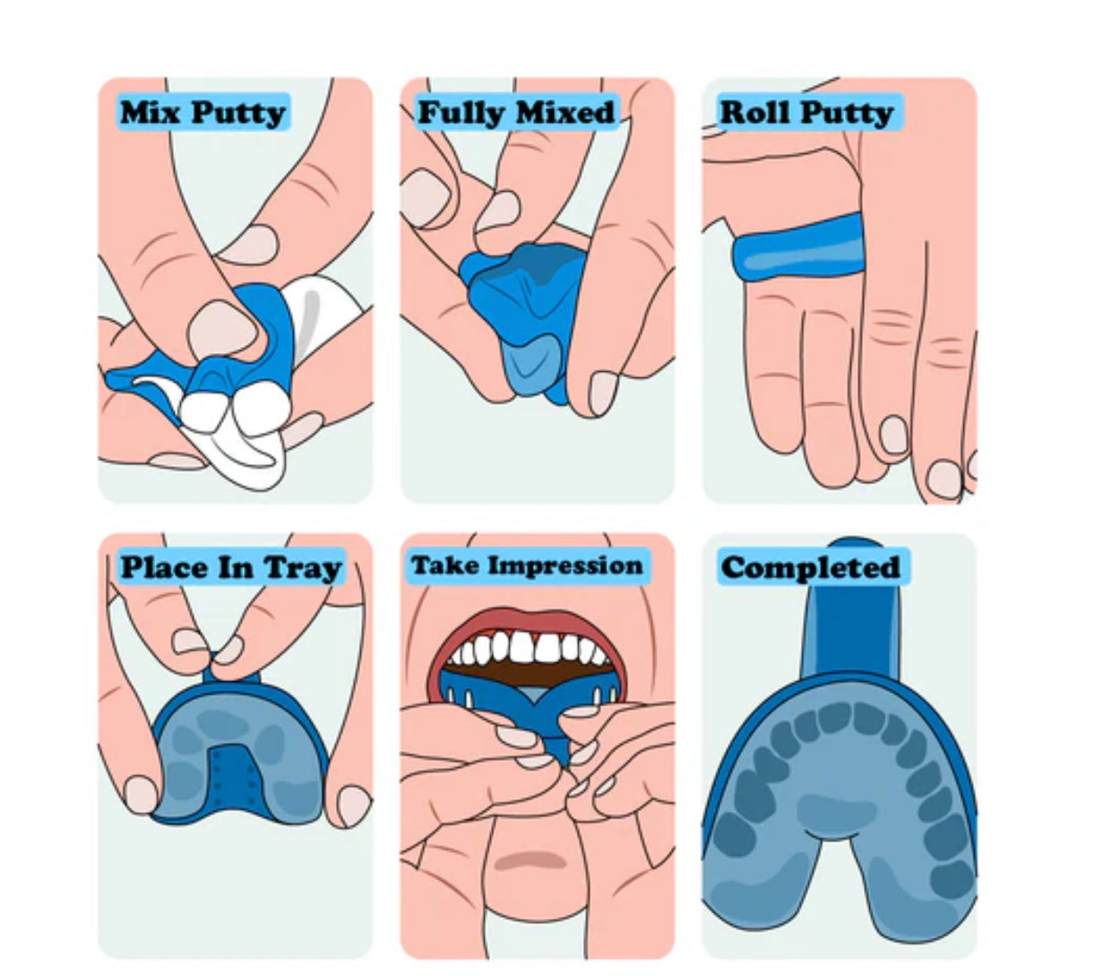 Molding kit