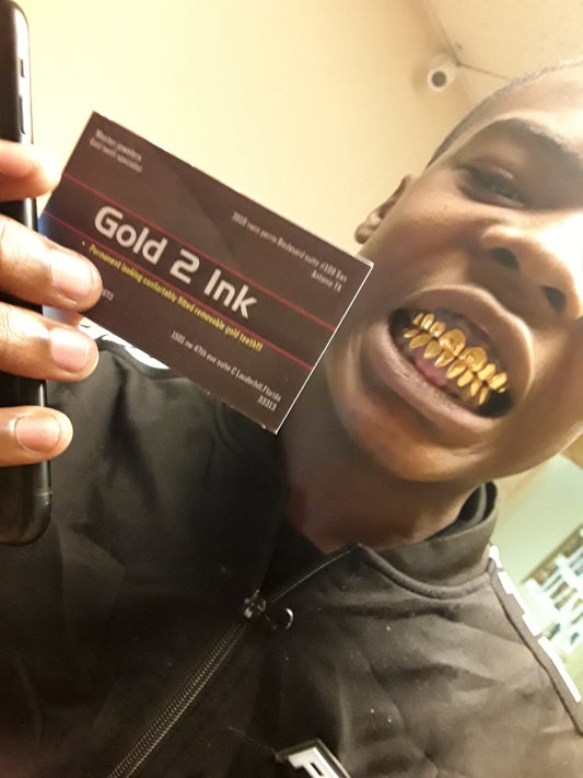 Dental gold/NPG (24 wall special) 12TP/12BTM