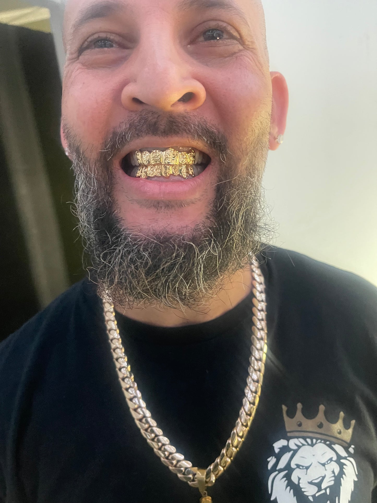 -14kt gold per tooth (pullouts)