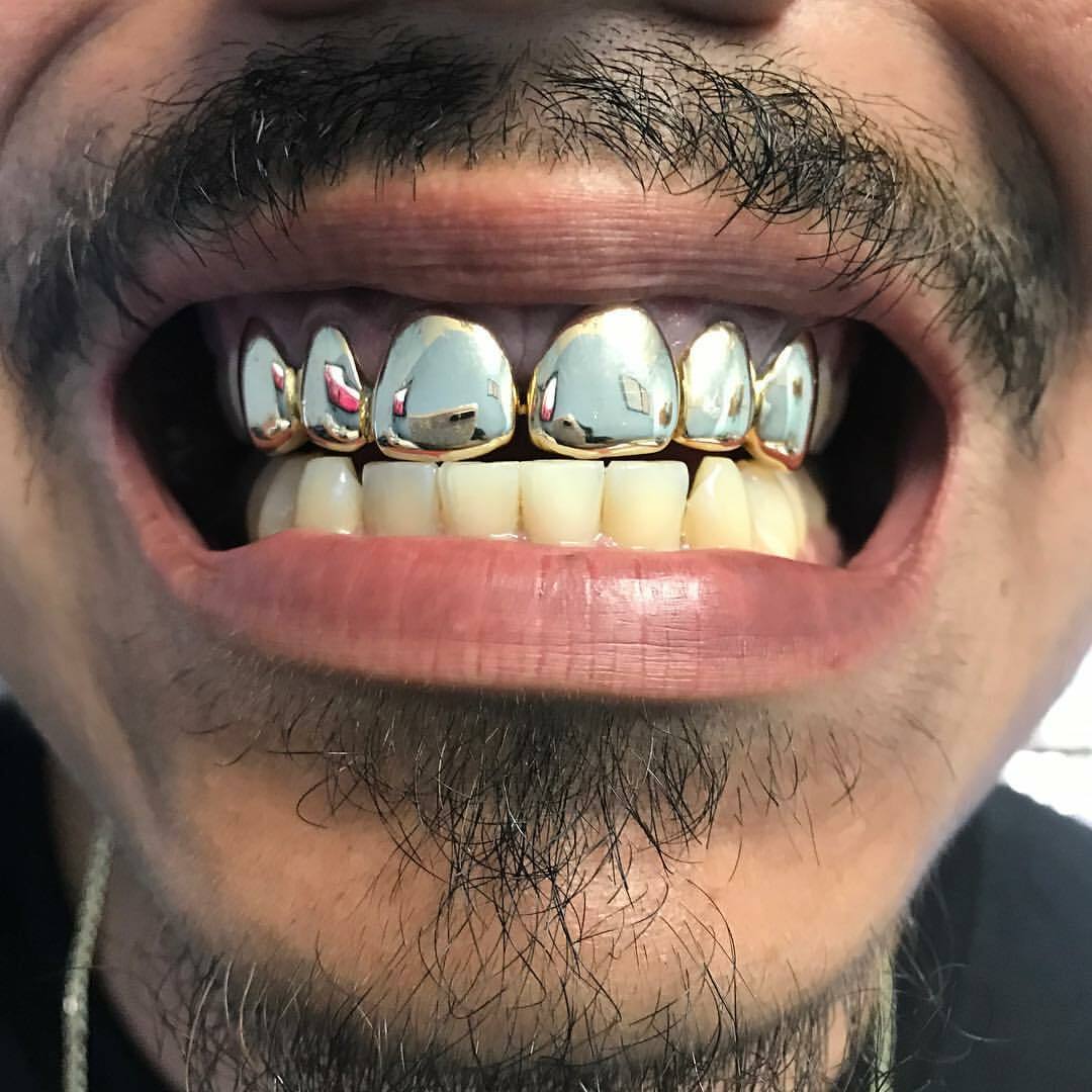 8kt gold per tooth (Pullouts)