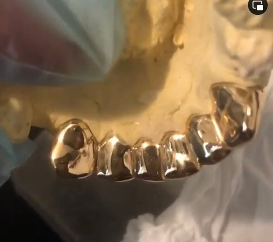 22kt Permanent teeth /crowns