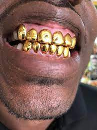 Dental gold/NPG (special) 6TP/6BTM