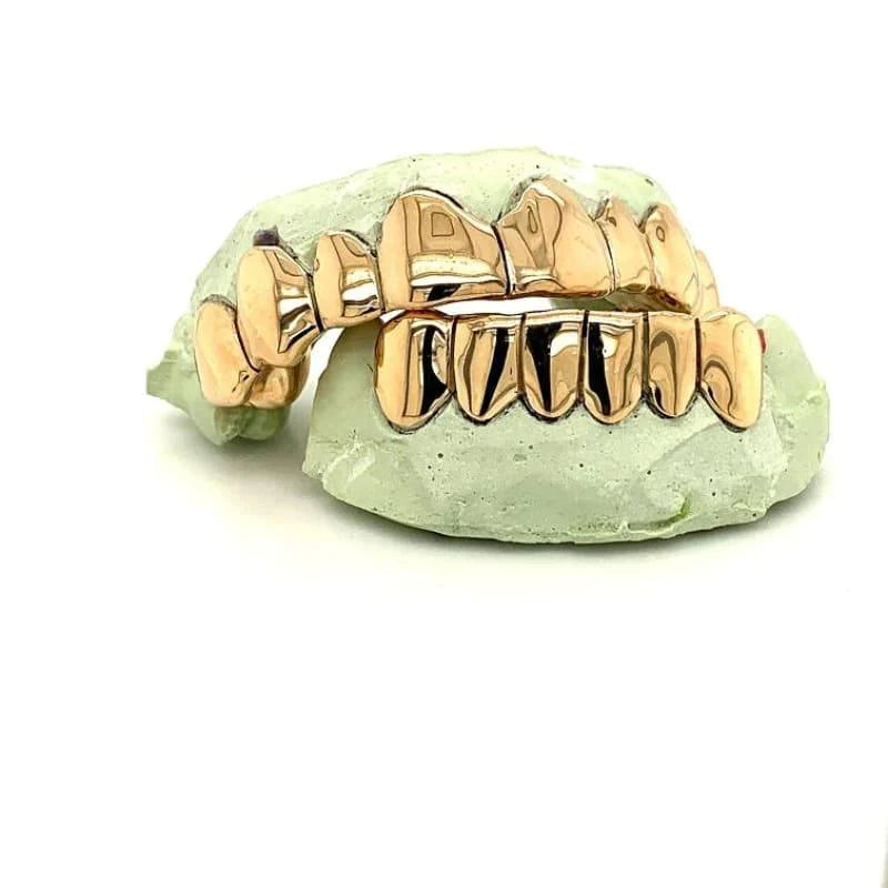 14kt gold per tooth (pullouts)