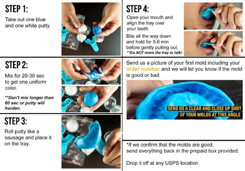 Molding kit