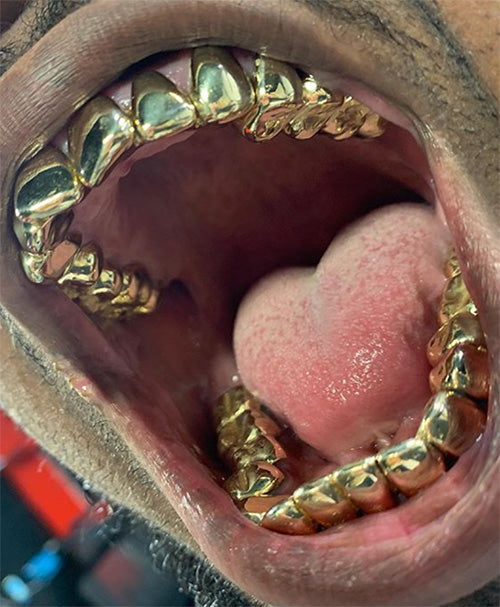 Dental gold/NPG (24 wall special) 12TP/12BTM