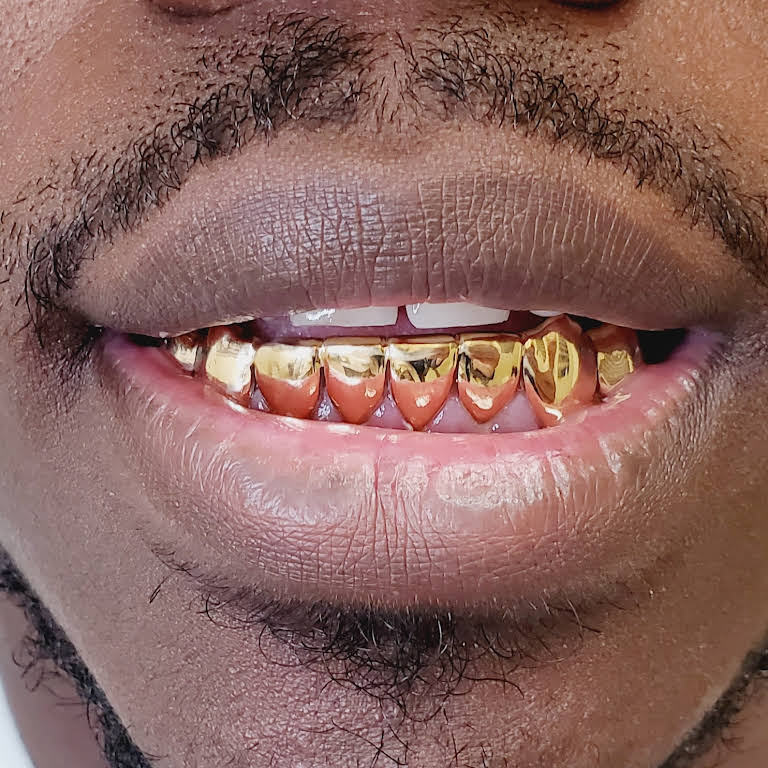 18k Permanent Teeth crowns Gold2ink 18k-permanent-teeth-crowns-gold2ink