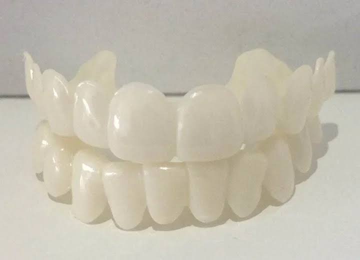 Gold2inks (removable veneers)