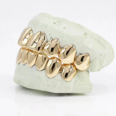 10k gold per tooth (single crown for permanent use)
