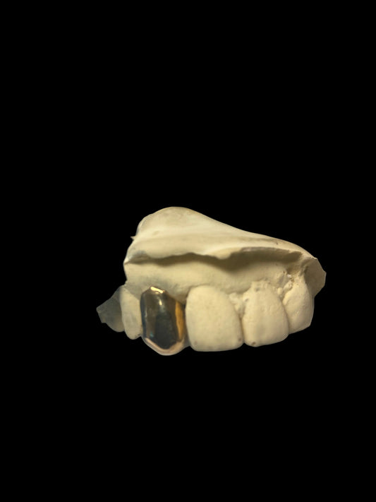 10kt gold per tooth (single crown for permanent use)