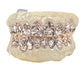 Add designs to your grillz