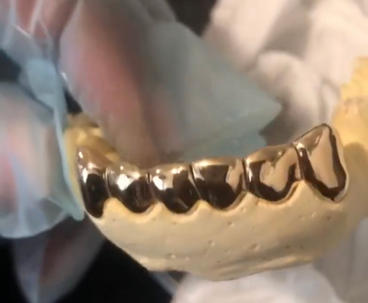 18k Permanent teeth /crowns