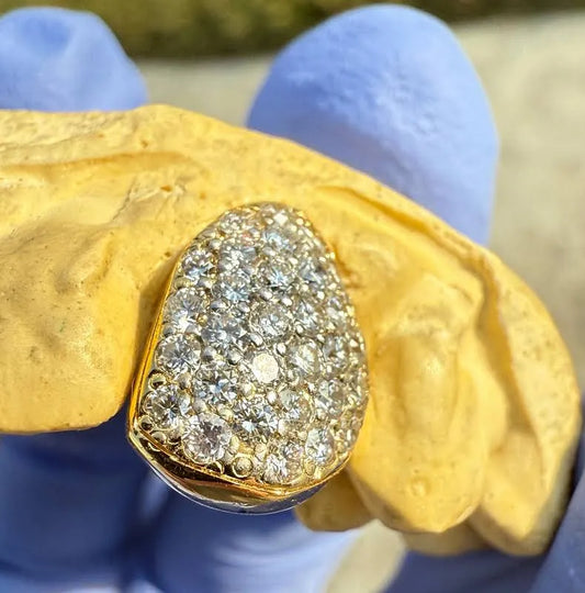 (Dental gold) single crown flooded vvs qaulity mossinite 💎 (For permanent use)