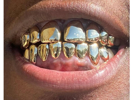 10k gold per tooth (Pullouts) (UD)