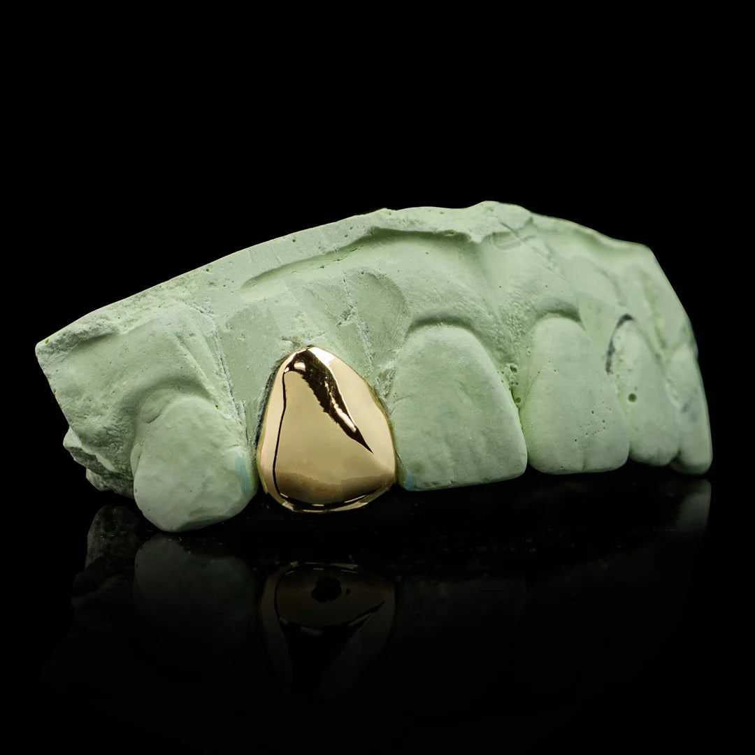 10kt gold per tooth (single crown for permanent use)