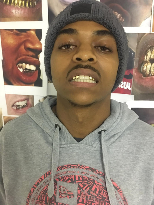 10kt gold per tooth (single crown for permanent use)