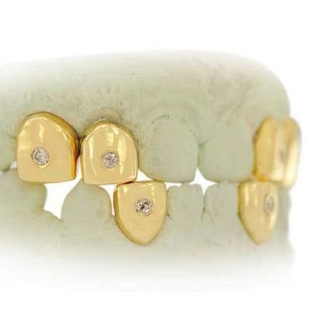 Dental gold ,single vvs mossinite diamond set(Pullouts)