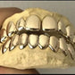 10k gold per tooth (single crown for permanent use)