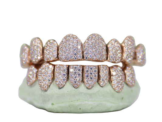 Dental gold-flooded vvs qaulity mossinite 💎 (For removable grillz use)