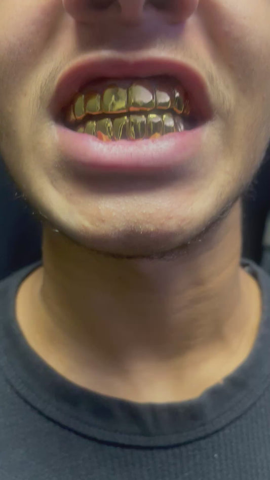 18k Permanent teeth /crowns