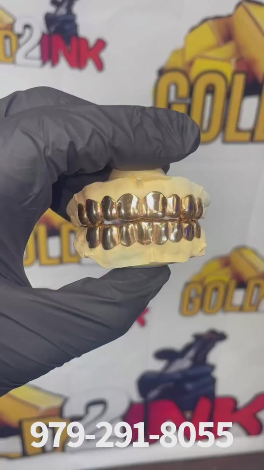 (Dental gold)/NPG (special) 10TP & 10BTM😬20 wall