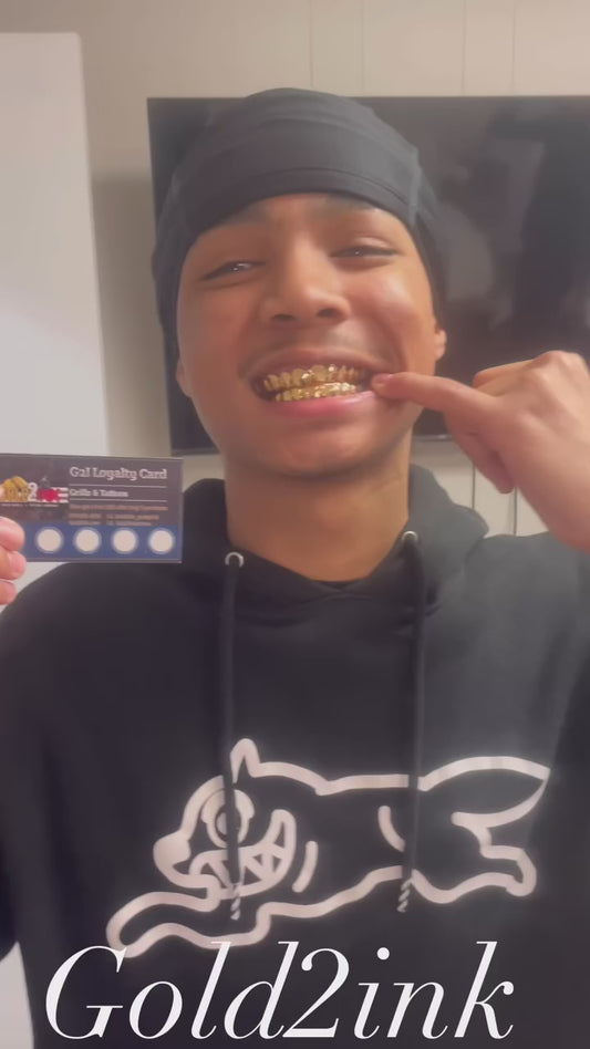 (Dental gold)/NPG (special) 10TP & 10BTM😬20 wall