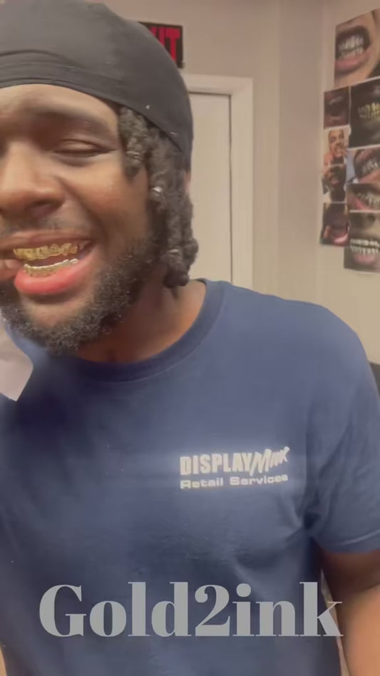 8kt gold per tooth (Pullouts)