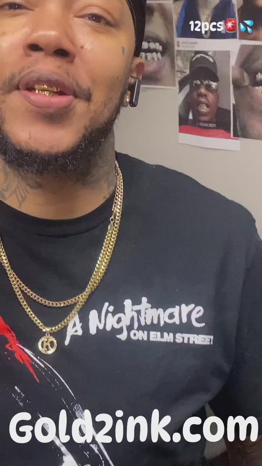 (Dental gold)/NPG (special) 6TP/6BTM