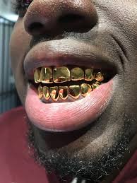 Dental gold/NPG (special) 8TP/8BTM