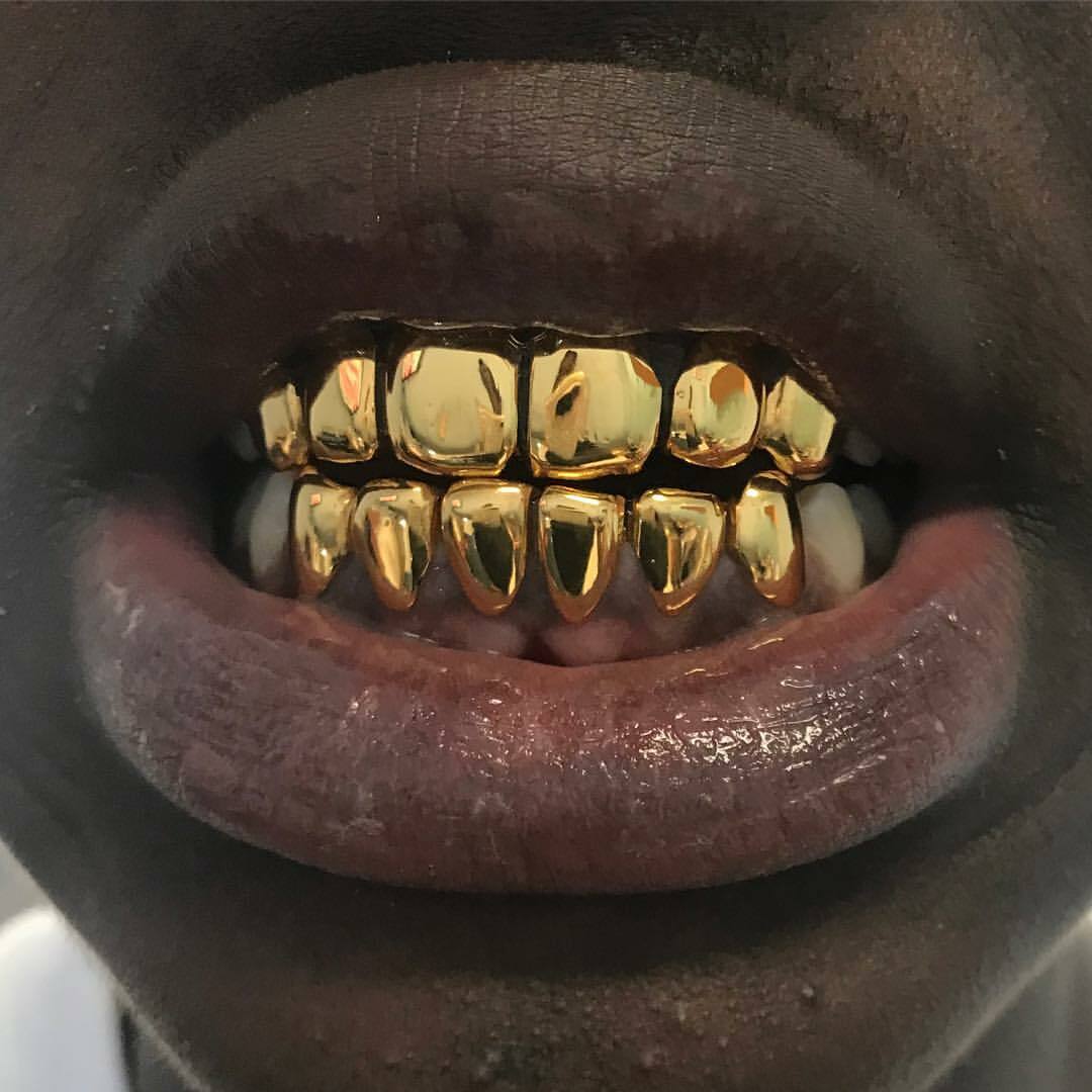 Dental gold/NPG (special) 6TP/6BTM