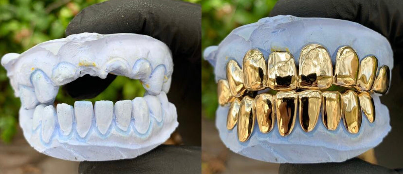 Replace missing tooth