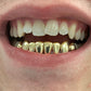 10k gold per tooth (Pullouts)