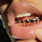 14kt gold per tooth (pullouts)