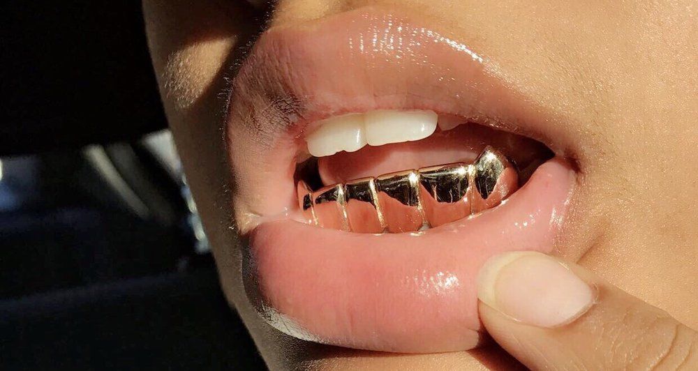 14kt gold per tooth (pullouts)