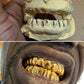 Replace missing tooth