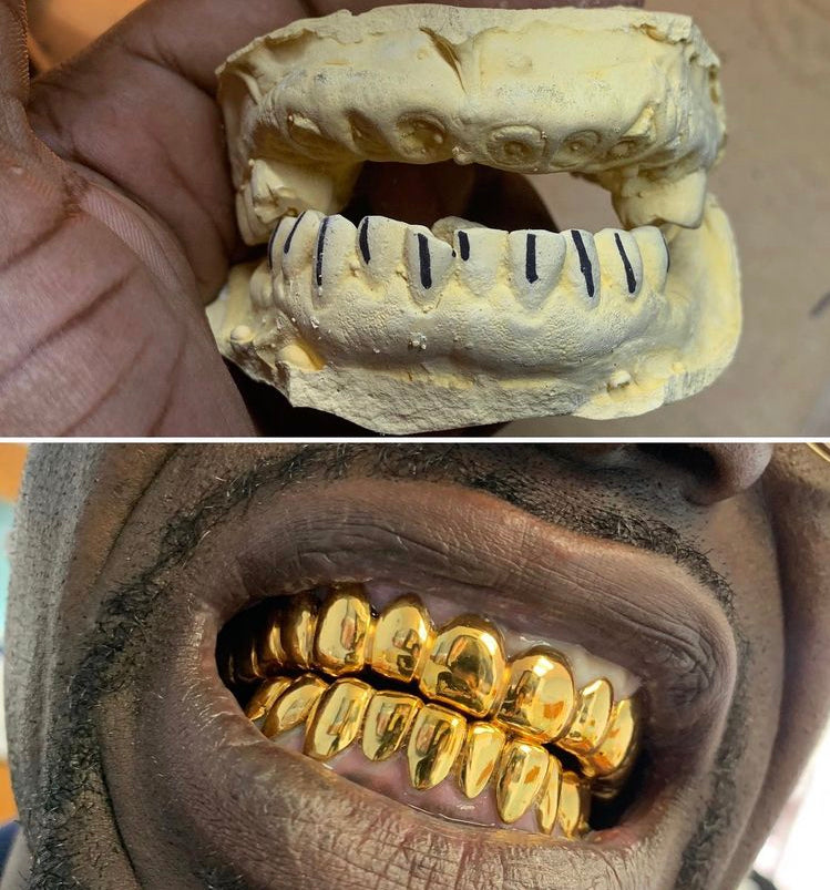Replace missing tooth