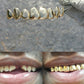 Replace missing tooth