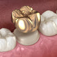18k Permanent teeth /crowns