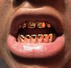 14k Permanent teeth /crowns